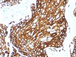 Cytokeratin, Acidic (Type I or LMW) Recombinant Rabbit Monoclonal Antibody (KRTL, 1577R)