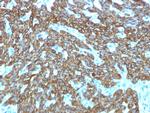 Cytokeratin, Basic (Type II or HMW) Recombinant Rabbit Monoclonal Antibody (KRTH, 1576R)
