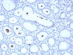 Helicobacter pylori (Catalase) Recombinant Rabbit Monoclonal Antibody (HPYL/8548R)