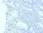 Helicobacter pylori (Catalase) Recombinant Rabbit Monoclonal Antibody (HPYL/8575R)