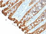 Cytokeratin 8/18 Recombinant Rabbit Monoclonal Antibody (KRT8.18/2297R)