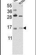 RBM3 Antibody in Western Blot (WB)