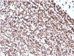 Double Stranded DNA (dsDNA) Recombinant Rabbit Monoclonal Antibody (DSD, 4054R)