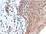 Double Stranded DNA (dsDNA) Antibody in Immunohistochemistry (Paraffin) (IHC (P))