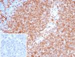 Pan-HLA-II (DP, DQ, DR) Recombinant Rabbit Monoclonal Antibody (HLA-Pan/8311R)