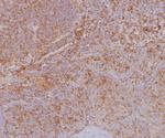 HLA Class 1 ABC (MHC I) Antibody in Immunohistochemistry (Paraffin) (IHC (P))