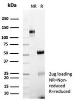 HLA Class 1 ABC (MHC I) Antibody in SDS-PAGE (SDS-PAGE)