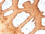 Cytokeratin, Type II (Epithelial Marker) Antibody in Immunohistochemistry (Paraffin) (IHC (P))