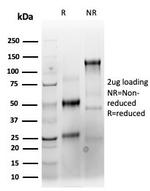 Cytokeratin, Type II (Epithelial Marker) Antibody in SDS-PAGE (SDS-PAGE)