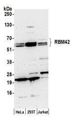 RBM42 Antibody in Western Blot (WB)
