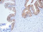 Cytokeratin, pan (Epithelial Marker) Recombinant Rabbit Monoclonal Antibody (Cocktail PCK/4933R)