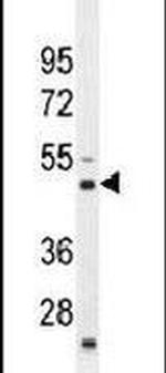 RBM43 Antibody in Western Blot (WB)
