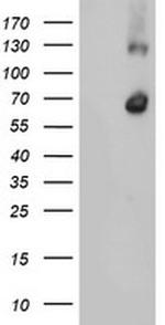 RBM46 Antibody in Western Blot (WB)