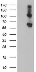RBM46 Antibody in Western Blot (WB)