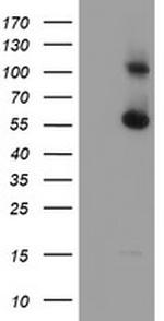 RBM46 Antibody in Western Blot (WB)