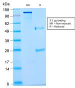 Nuclear Antigen Antibody in SDS-PAGE (SDS-PAGE)