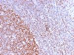 Nuclear Antigen Antibody in Immunohistochemistry (Paraffin) (IHC (P))