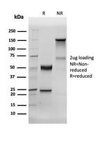 Human Nuclear Antigen (HNA) (Human Cell Marker) Antibody in Immunoelectrophoresis (IE)