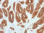 Cytokeratin, Type I (Epithelial Marker) Recombinant Rabbit Monoclonal Antibody (KRTL/7784R)