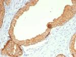 Cytokeratin, Type II (Epithelial Marker) Recombinant Rabbit Monoclonal Antibody (KRTH/4392R)