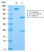 Mitochondria Antibody in SDS-PAGE (SDS-PAGE)