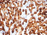 HBsAg (Hepatitis B surface Ag a determinant) Recombinant Rabbit Monoclonal Antibody (HBsAg/7556R)