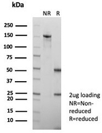 HBsAg (Hepatitis B surface Ag a determinant) Antibody in SDS-PAGE (SDS-PAGE)