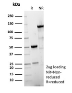 Hexa-histidine (Epitope Tag) Antibody in SDS-PAGE (SDS-PAGE)