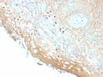 HPV-16 (Human Papilloma Virus 16) Recombinant Rabbit Monoclonal Antibody (HPV16, 2058R)