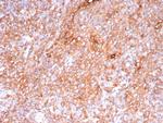 Pan-HLA-II (DP, DQ, DR) Recombinant Rabbit Monoclonal Antibody (HLA-Pan/9268R)