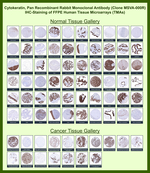 Cytokeratin, pan (Epithelial Marker) Recombinant Rabbit Monoclonal Antibody (MSVA-000R)