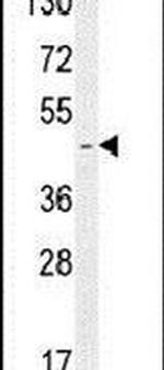 RBMX2 Antibody in Western Blot (WB)