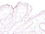 Helicobacter Pylori Polyclonal Antibody