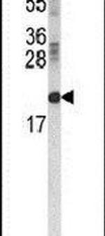 RBP2 Antibody in Western Blot (WB)