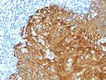 Cytokeratin, pan (Epithelial Marker) Antibody in Immunohistochemistry (Paraffin) (IHC (P))