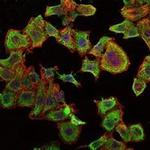 RBP4 Monoclonal Antibody (4C2)