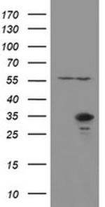 RBPMS Antibody in Western Blot (WB)