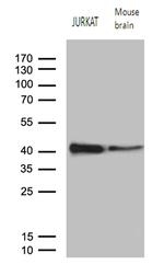RCAN1 Antibody in Western Blot (WB)
