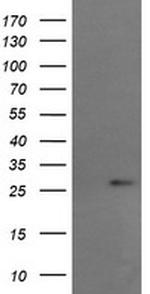 RCAN3 Antibody in Western Blot (WB)
