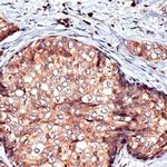 RCAS1 Antibody in Immunohistochemistry (IHC)