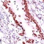 RCC1 Antibody in Immunohistochemistry (IHC)