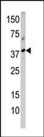 RCL1 Antibody in Western Blot (WB)