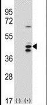 RCL1 Antibody in Western Blot (WB)