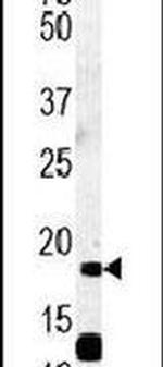RCL Antibody in Western Blot (WB)