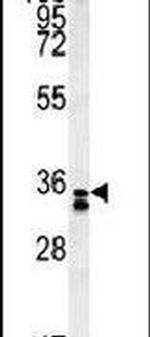 RCN3 Antibody in Western Blot (WB)