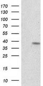 RDH14 Antibody in Western Blot (WB)