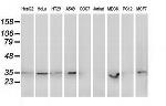 RDH14 Antibody in Western Blot (WB)