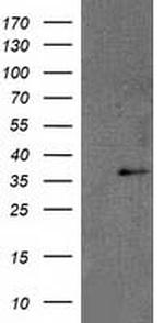 RDH14 Antibody in Western Blot (WB)