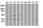 RDH14 Antibody in Western Blot (WB)