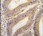 REA Antibody in Immunohistochemistry (IHC)